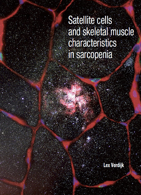 Cover-Satellite-cells-and-skeletal-muscle-characteristics-in-sarcopenia